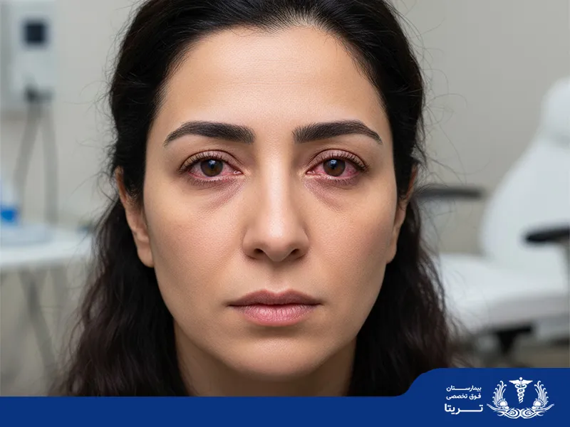 آیا خارش چشم خطرناک است؟